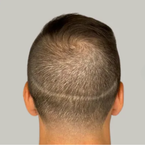 Untitled-design-43 Untitled-design-43